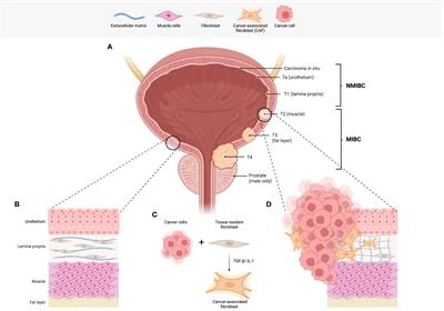 A review of the biology and therapeutic implications of cancer-associated fibroblasts (CAFs) in muscle-invasive bladder cancer